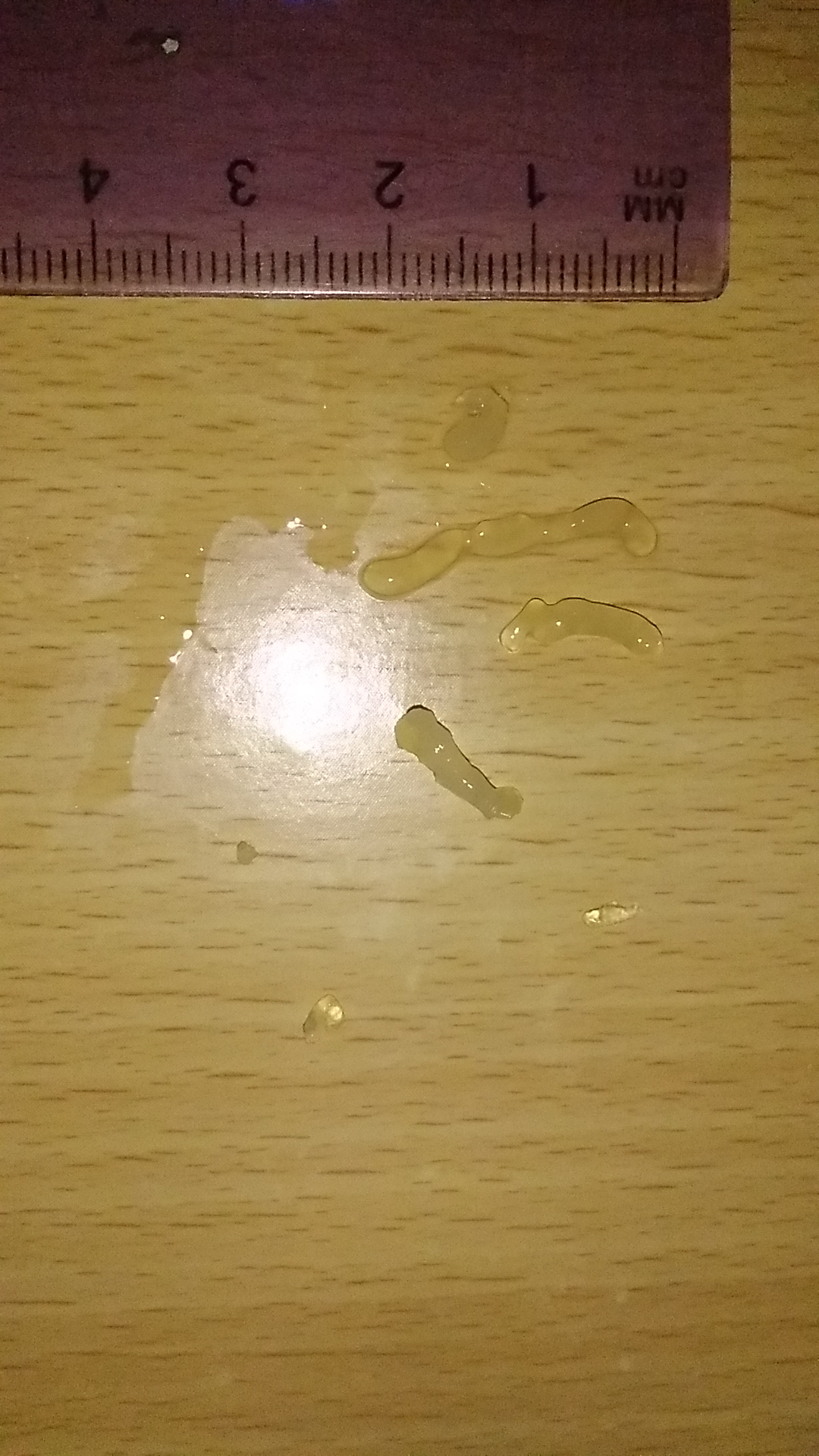 сперма с желтой жидкостью фото 17