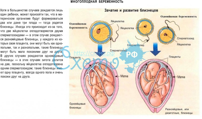 Двойня от эко: вероятность беременности двойней после эко, многоплодная беременность и особенности вынашивания близнецов