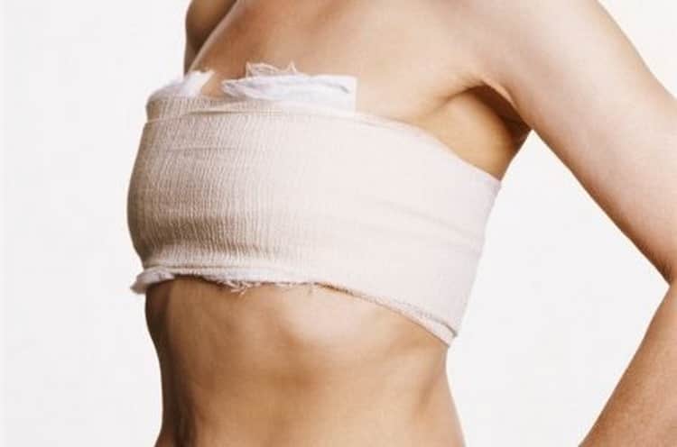 Как правильно перетянуть молочные железы для предотвращения лактации: все “за и против” перевязки груди с фото