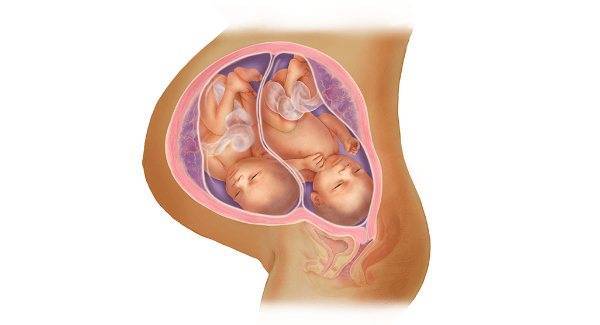 Двойня от эко: вероятность беременности двойней после эко, многоплодная беременность и особенности вынашивания близнецов