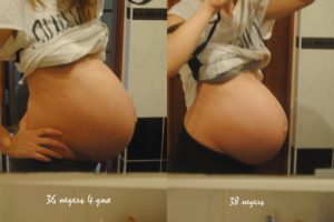 Когда опускается живот перед родами: признаки, ощущения беременной