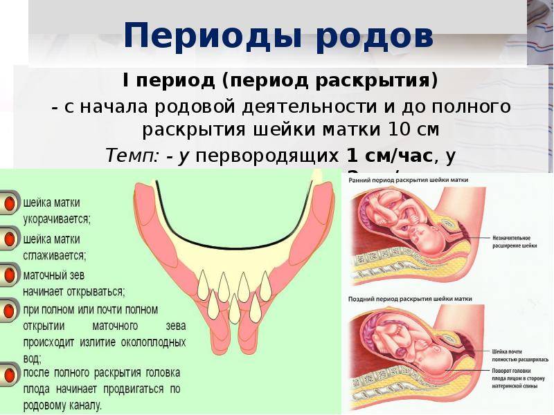 Раскрытие шейки матки на 1 или 2 пальца. как ускорить раскрытие перед родами | азбука здоровья