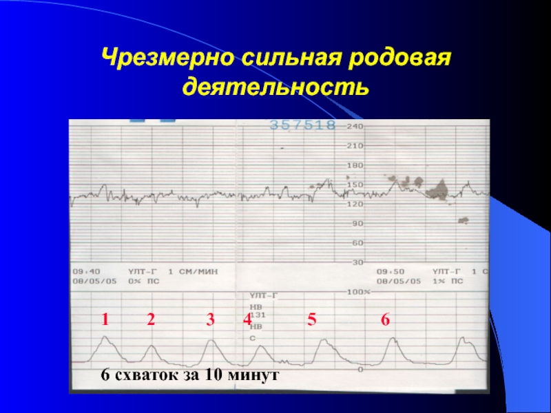 Что означают цифры на ктг на мониторе