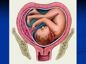 Можно ли забеременеть при опущении матки: выносить и родить | vrachmatki
