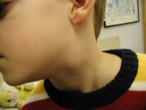Возможные причины шейных болей у детей: симптомы, как помочь ребенку
