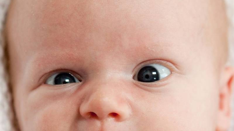Гимнастика для глаз при косоглазии у детей разных возрастов — глаза эксперт