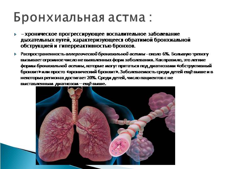 Бронхиальная болезнь легких. Хроническая бронхиальная астма. Астма это хроническое заболевание.