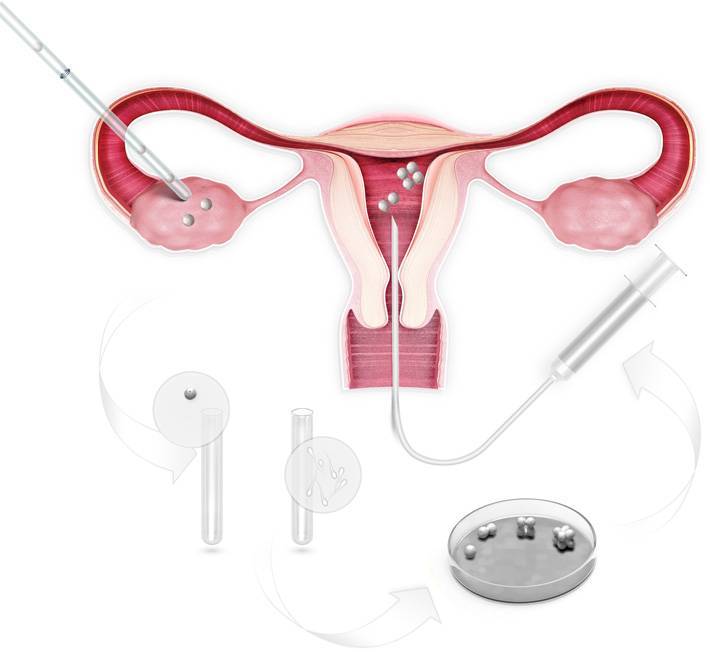 После переноса эмбрионов: когда он должен прижиться в матке