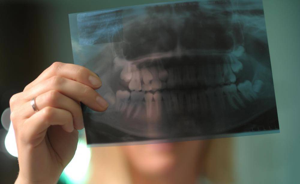 Сколько раз можно делать рентген зубов - профимед - эстетическая стоматология