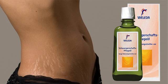 Помогает ли оливковое масло от растяжек во время беременности?
