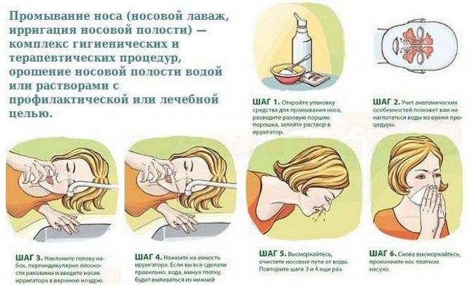 Промывание носа солевым раствором: как правильно делать в домашних условиях