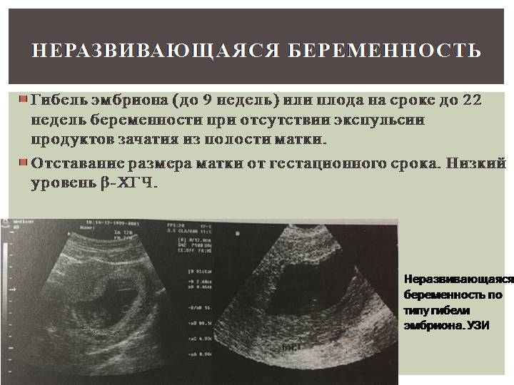 Патологии беременности первого, второго и третьего триместра: какие патологии при беременности бывают / mama66.ru