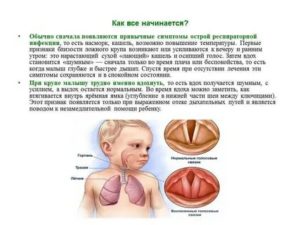 Чем лечить кашель от соплей у ребенка
