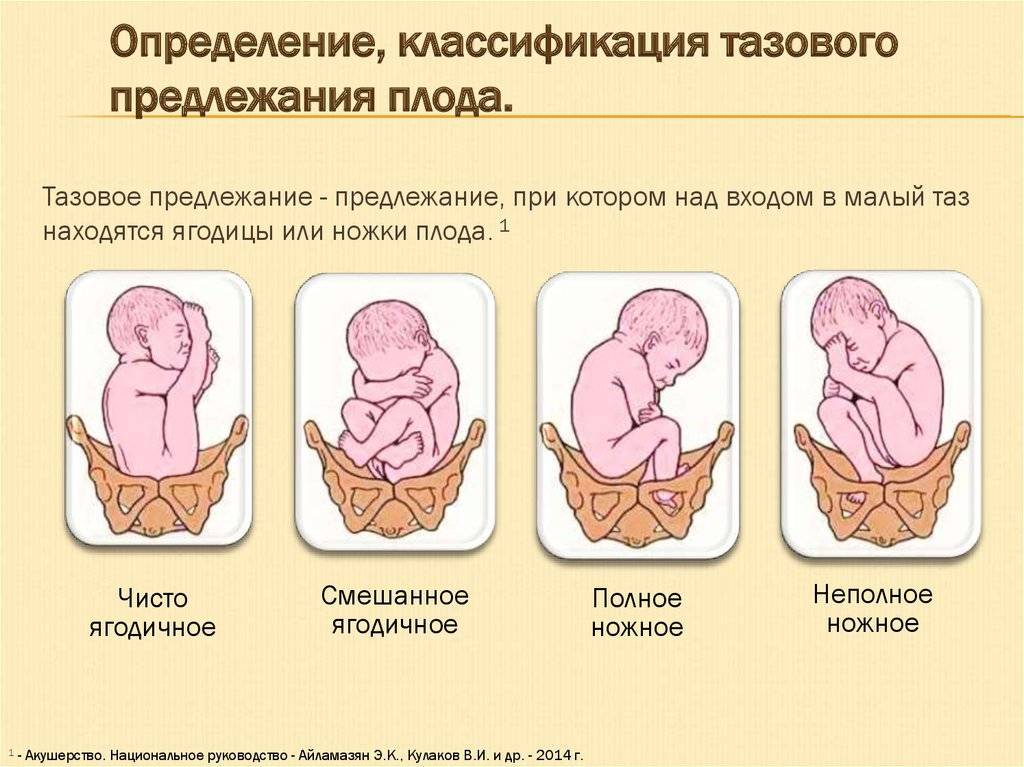 Когда ребенок переворачивается в животе вниз головой и принимает правильное положение (позу) перед родами