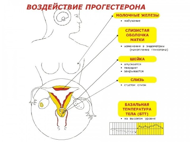 Трихомониаз при беременности: причины, симптомы и методы лечения инфекции