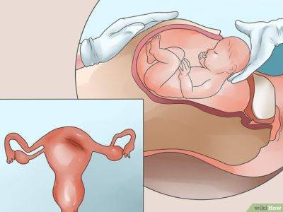Как безболезненно сходить в туалет после родов. послеродовой запор