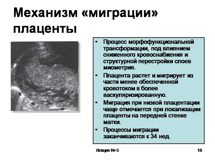 Когда формируется плацента при беременности: сроки, особенности процесса