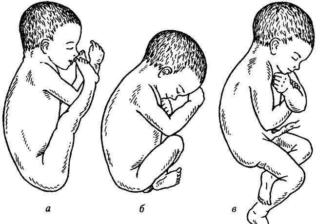 Поперечное и тазовое предлежание плода: упражнения для беременных