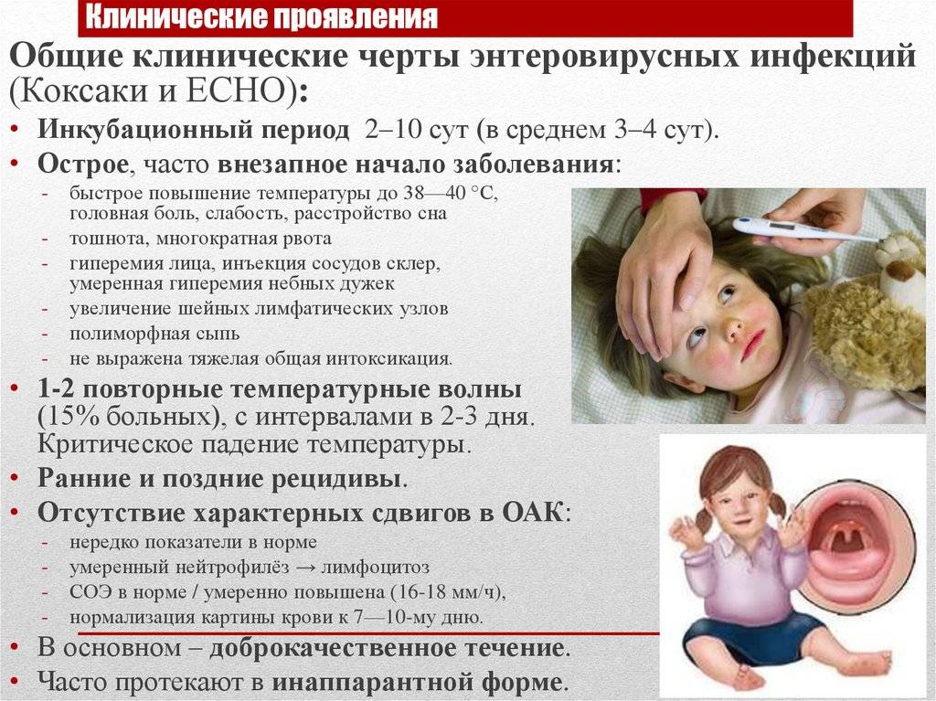 Е. комаровский: мононуклеоз у детей - симптомы и лечение, диета и восстановление