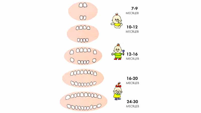 Порядок роста зубов у младенца: схема прорезывания и нарушения порядка, как облегчить состояние ребенка