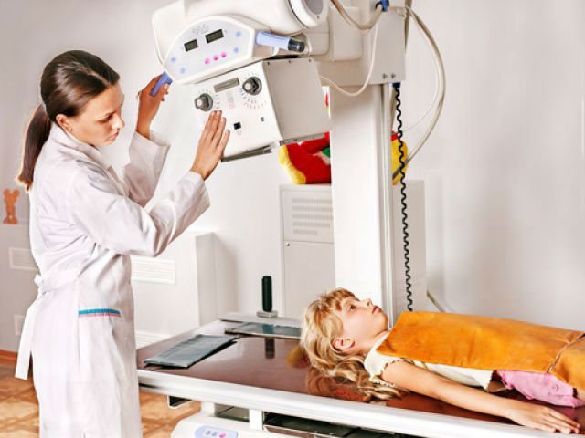 Как часто можно делать рентген ребенку и как это зависит от возраста