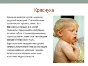 Коронавирус у ребенка - симптомы и правильное лечение
