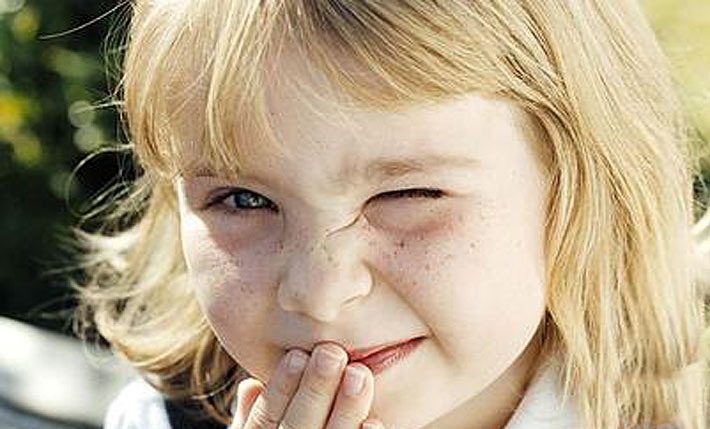 Причины частого моргания глазами у ребенка – как избавиться от надоедливого тика?