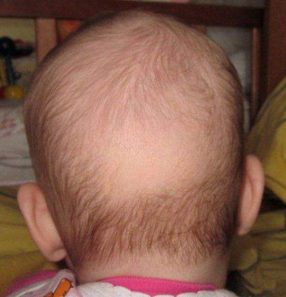 Медленно растут волосы у ребенка | уроки для мам