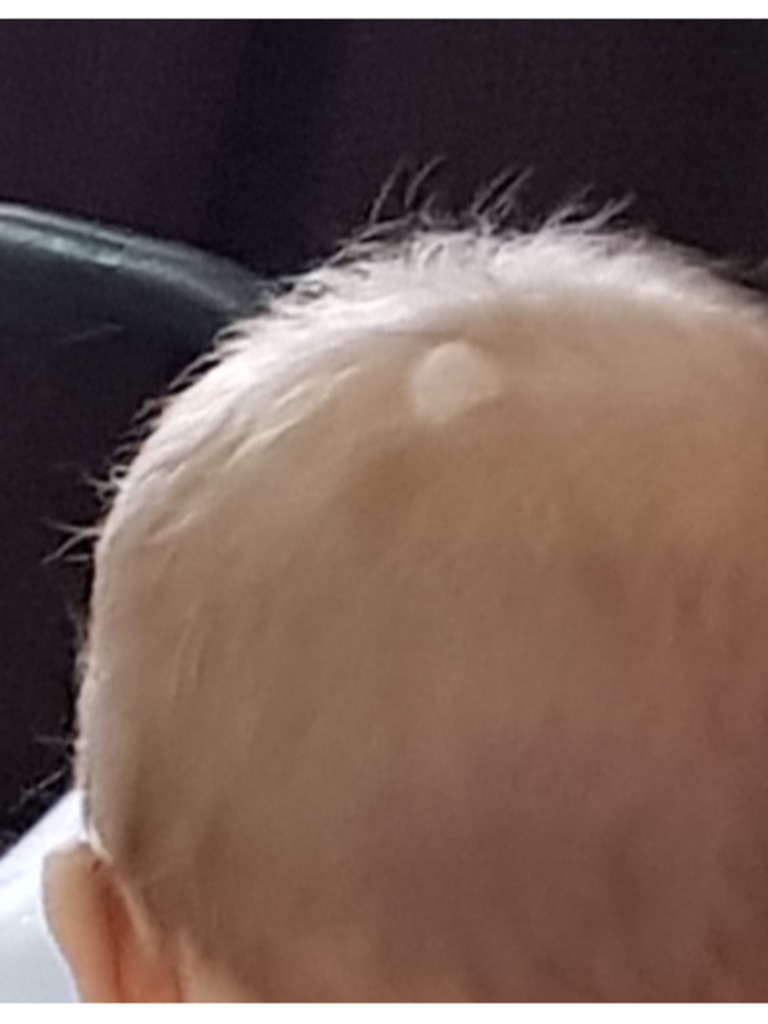 У ребенка плохо растут волосы на голове: что делать?