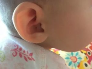 Почему ребенок чешет уши - причины и методы лечения