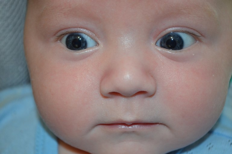 Как изменяется цвет глаз новорождённого ребёнка
