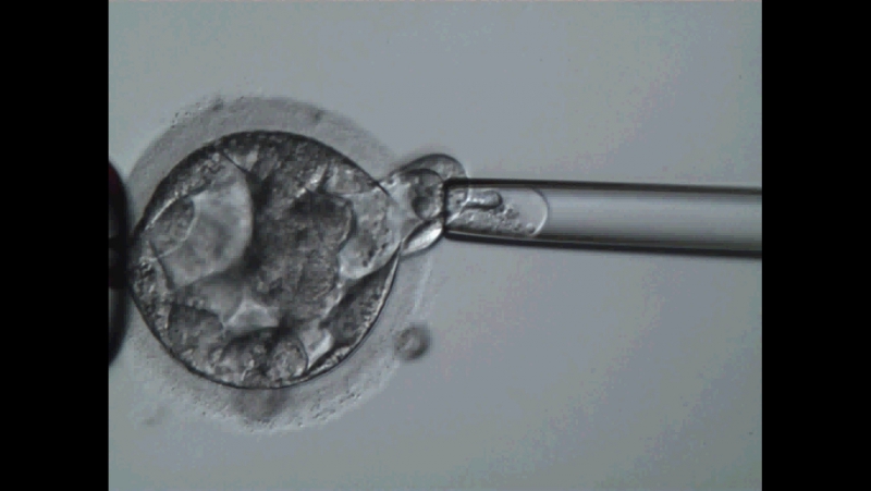 Подсадили эмбрион форум. Биопсия трофэктодермы эмбриона. Бластоциста хетчинг. Преимплантационная генетическая диагностика (ПГД). Биопсия трофоэктодермы 1 бластоциста.
