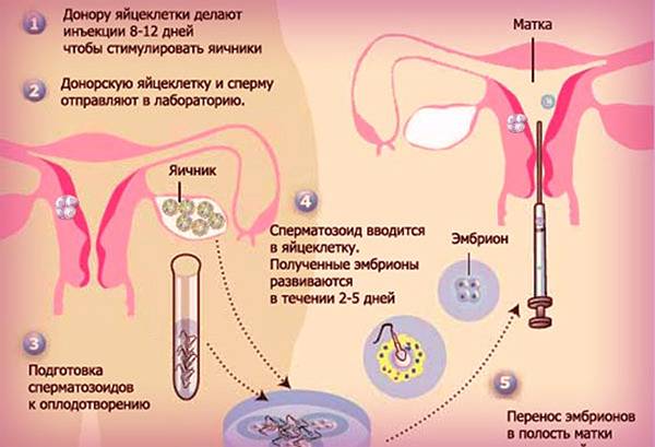 Успешная подсадка эмбрионов, эндометрий и окно имплантации