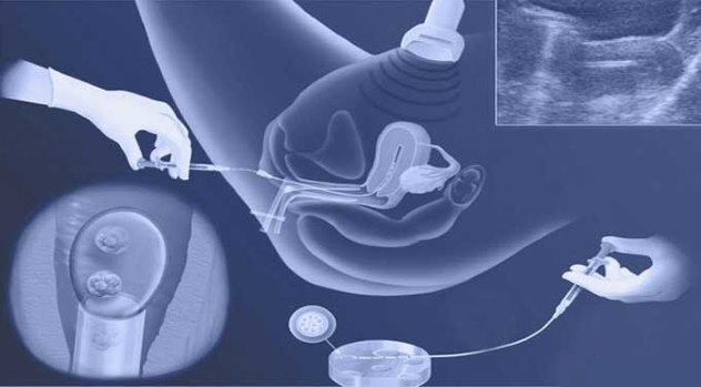 После переноски эмбрионов дует живот: причины и помощь