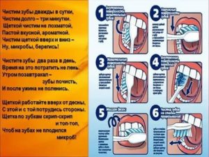 Профессиональная чистка зубов детям - лучшая профилактика болезней