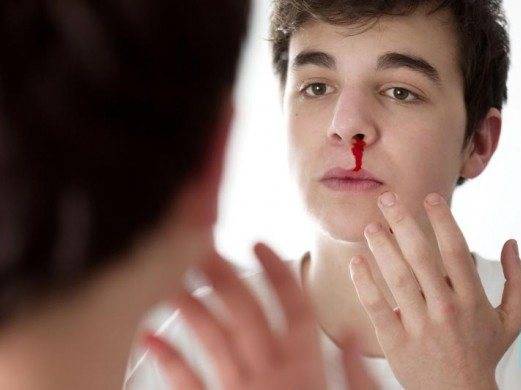 Опасны ли носовые кровотечения у детей и в чём их причина?