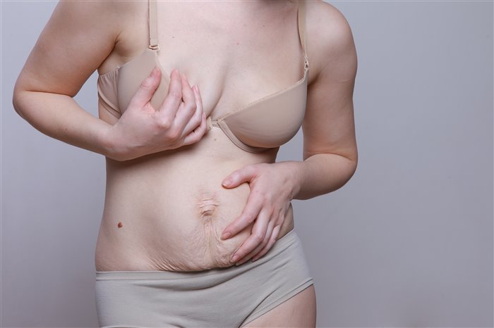 Как без операции можно подтянуть обвисшую грудь девушке и женщине после родов?