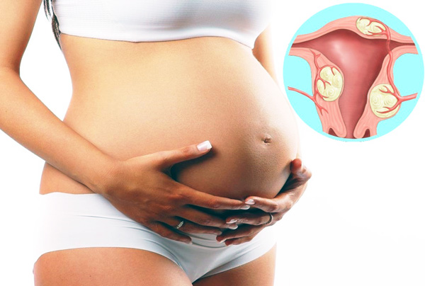 Опущение матки при беременности: можно ли забеременеть и рожать, какие симптомы указывают на патологию и как проходят роды