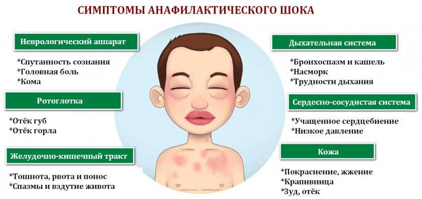 Бывает ли температура при аллергии у детей • аллергия и аллергические реакции