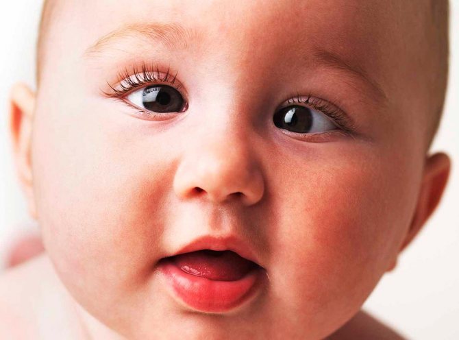 Косоглазие у новорождённых: симптомы, лечение - "здоровое око"