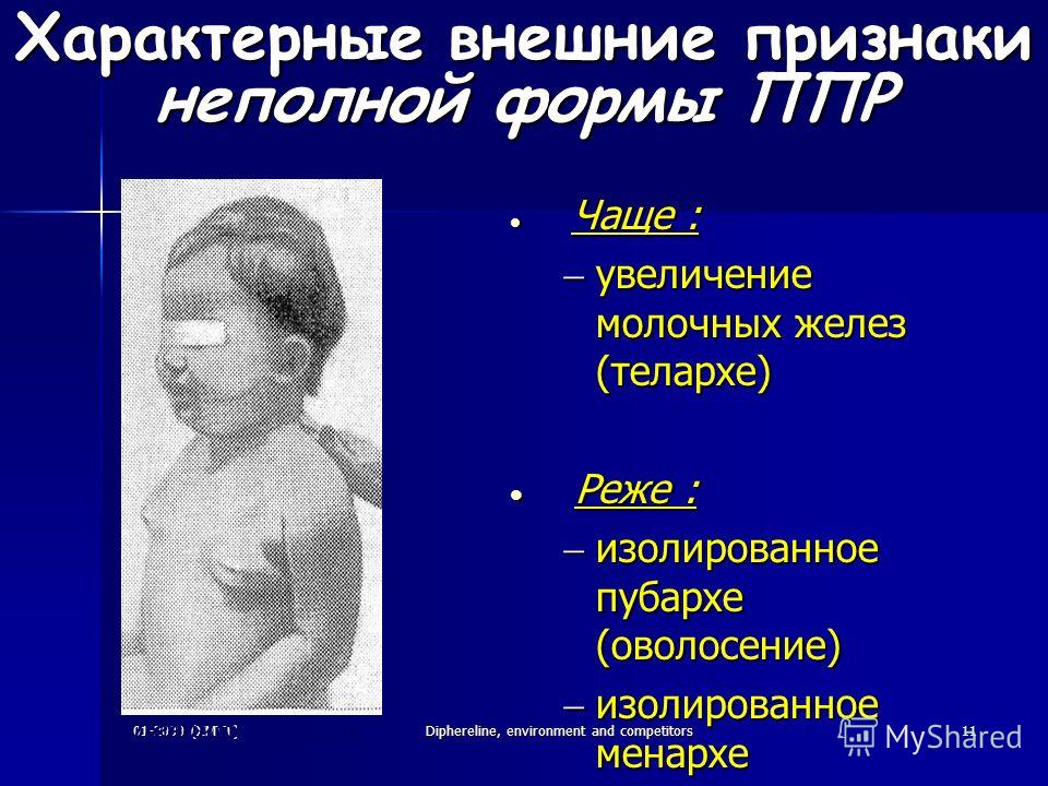Молочные железы у детей : физиология и патологии | компетентно о здоровье на ilive