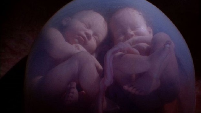 Двойняшки беременность: причины, признаки, роды и протекание беременности.