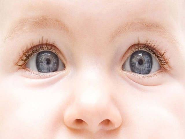Когда меняется цвет глаз у новорожденных + таблица изменений