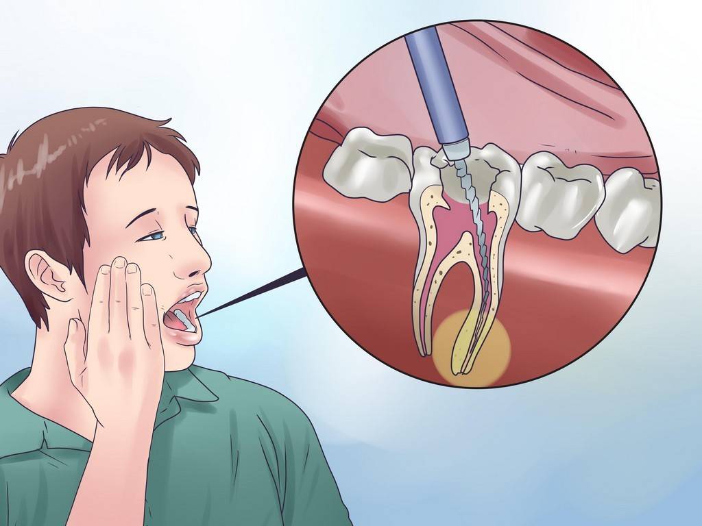 У ребенка болит зуб: чем обезболить в домашних условиях