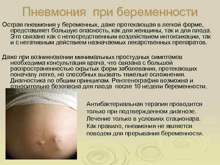 Фарингит при беременности: как и чем лечить, влияние на плод