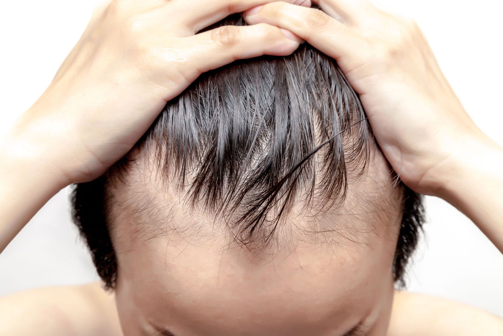По каким причинам у ребенка в 3 года выпадают волосы и чем лечить?