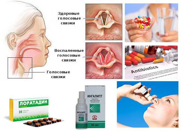 Отёк горла у ребёнка: причины, первая помощь pulmono.ru
отёк горла у ребёнка: причины, первая помощь