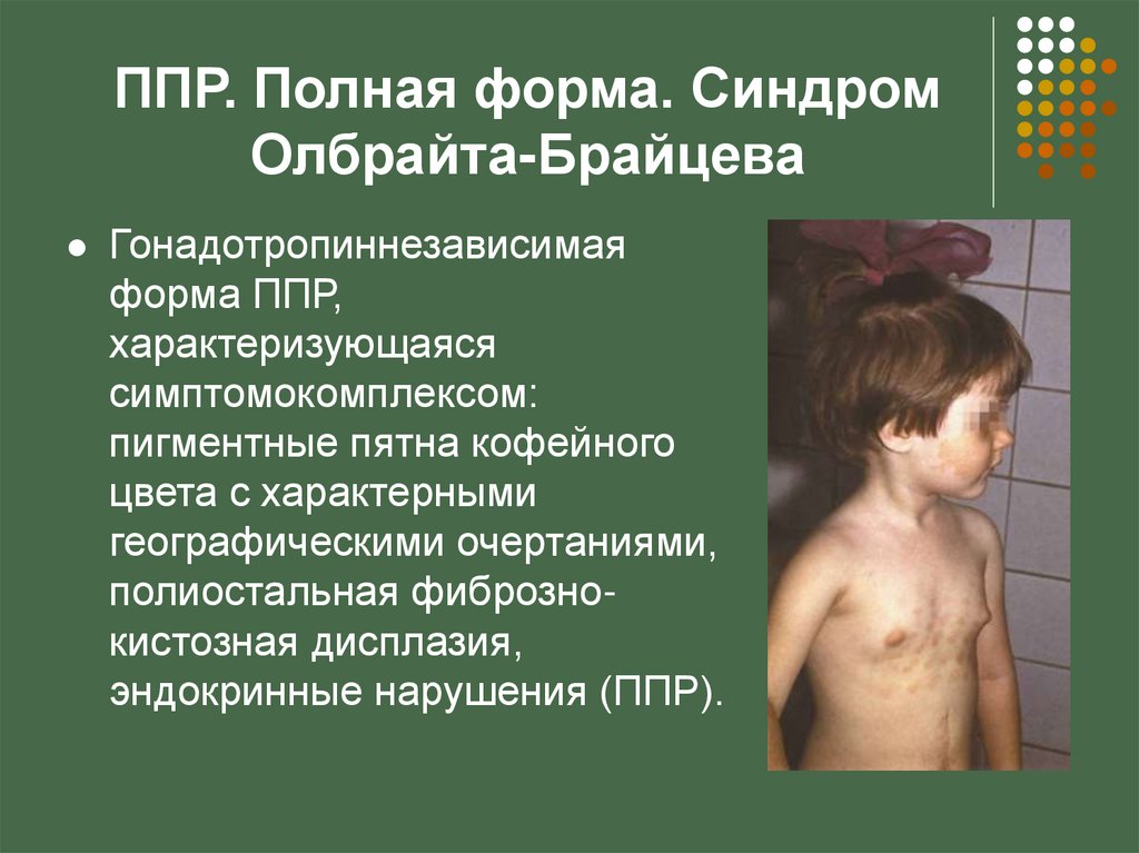 Телархе в 5 лет | все вопросы и ответы о "телархе в 5 лет" | 03.ru - скорая помощь онлайн