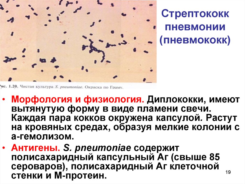 Streptococcus pyogenes: характеристика, что вызывает, симптомы, лечение