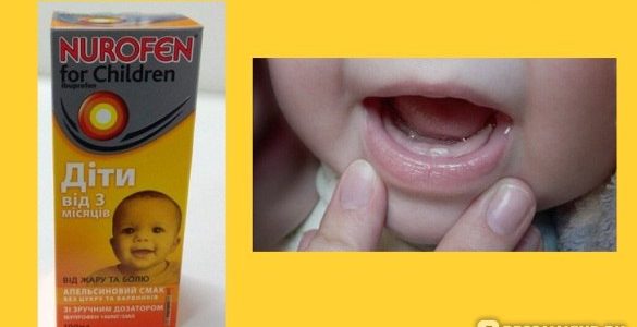 Нурофен при прорезывании зубов – особенности применения